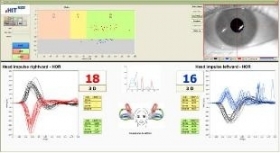Sistema Comby eVNG eHIT - EV.SERVICE ITALIA SRL